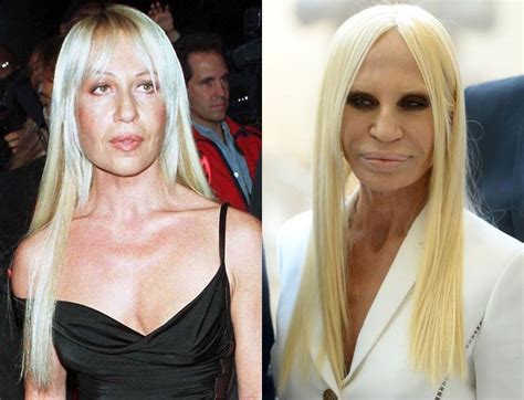 donatella versace plastic surgery before|Donatella Versace cosmetic surgery.